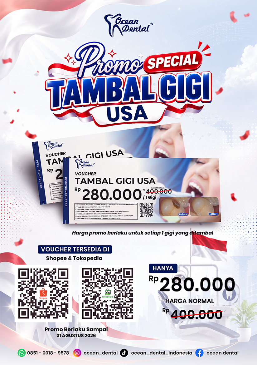 Promo spesial tambal gigi USA