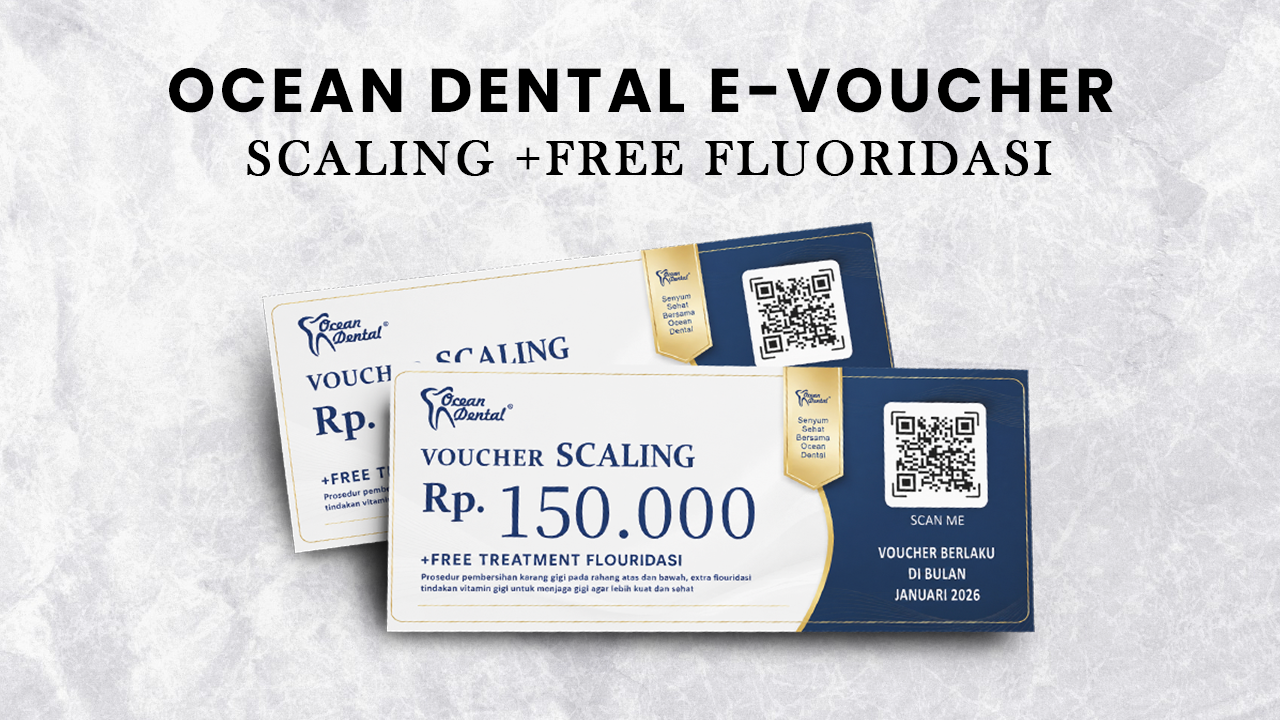 OCEAN DENTAL E-VOUCHER SCALING + FREE FLUORIDASI