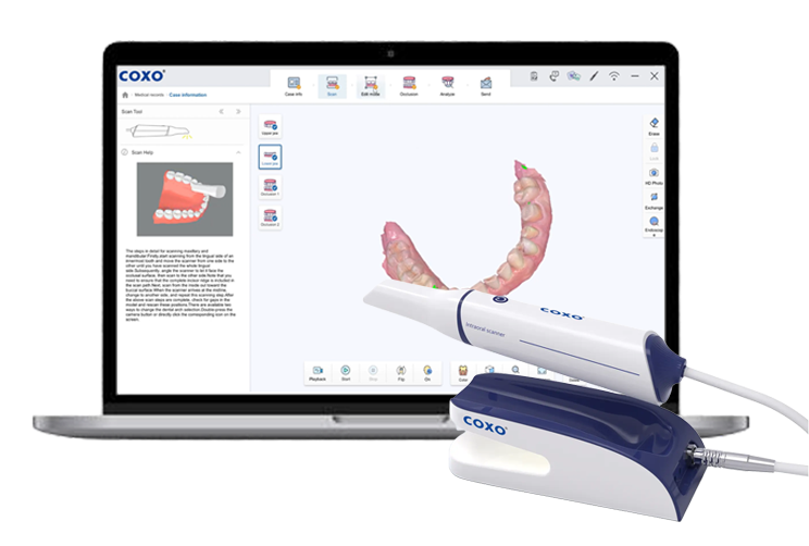 Intraoral Scanner